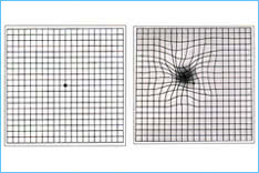 ARMD Amster Grid ARMD Amster Grid