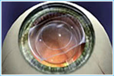 ICL2