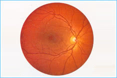 Normal-fundus Normal-fundus