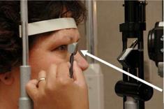Gonioscopy-evaluate-angle-anterior-chamber - Sunayana Eye Hospital Gonioscopy-evaluate-angle-anterior-chamber - Sunayana Eye Hospital