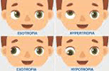 SQUINT Rectification
